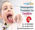 Get Effective Homeopathic Treatment for Tonsillitis